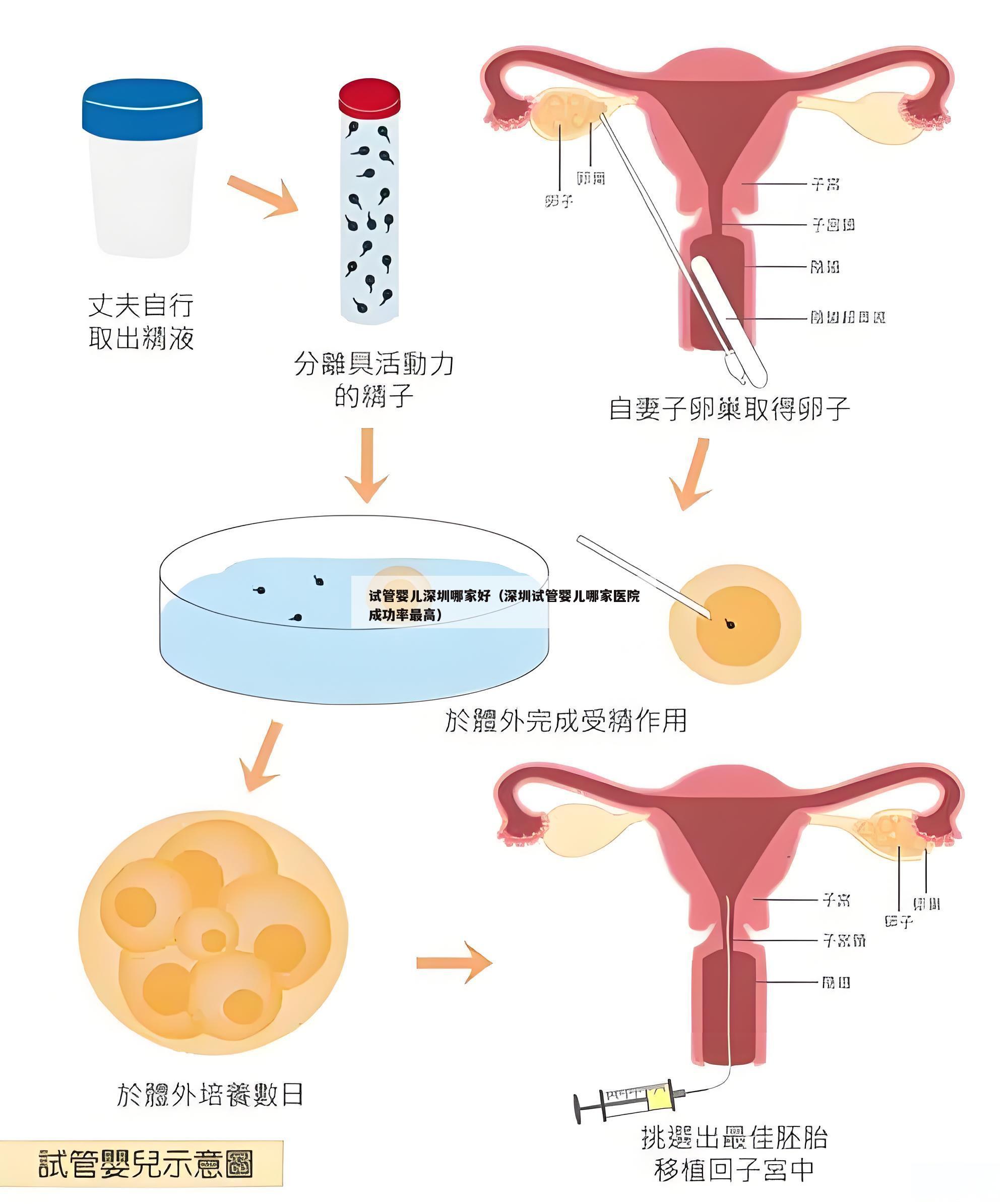 试管婴儿深圳哪家好（深圳试管婴儿哪家医院成功率最高）